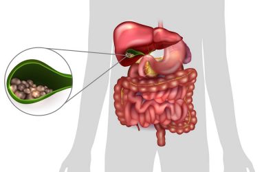 Can a Car Accident Cause Gallbladder Problems?