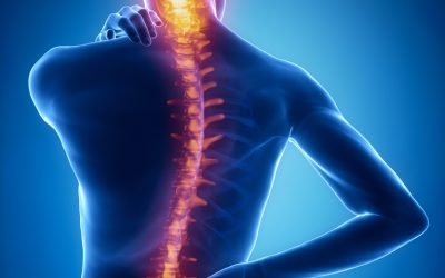 Can a Car Accident Cause Scoliosis?