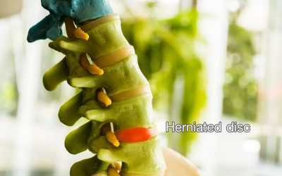 Can a Car Accident Cause a Herniated Disc?
